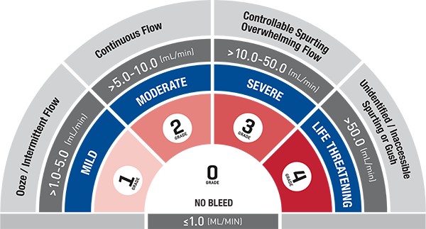 VIBe_SCALE_Solo